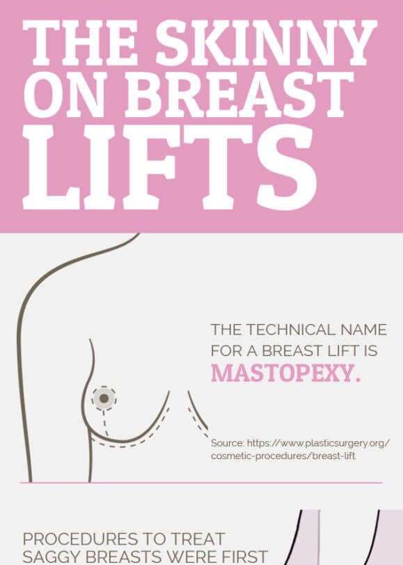 Breast Lift